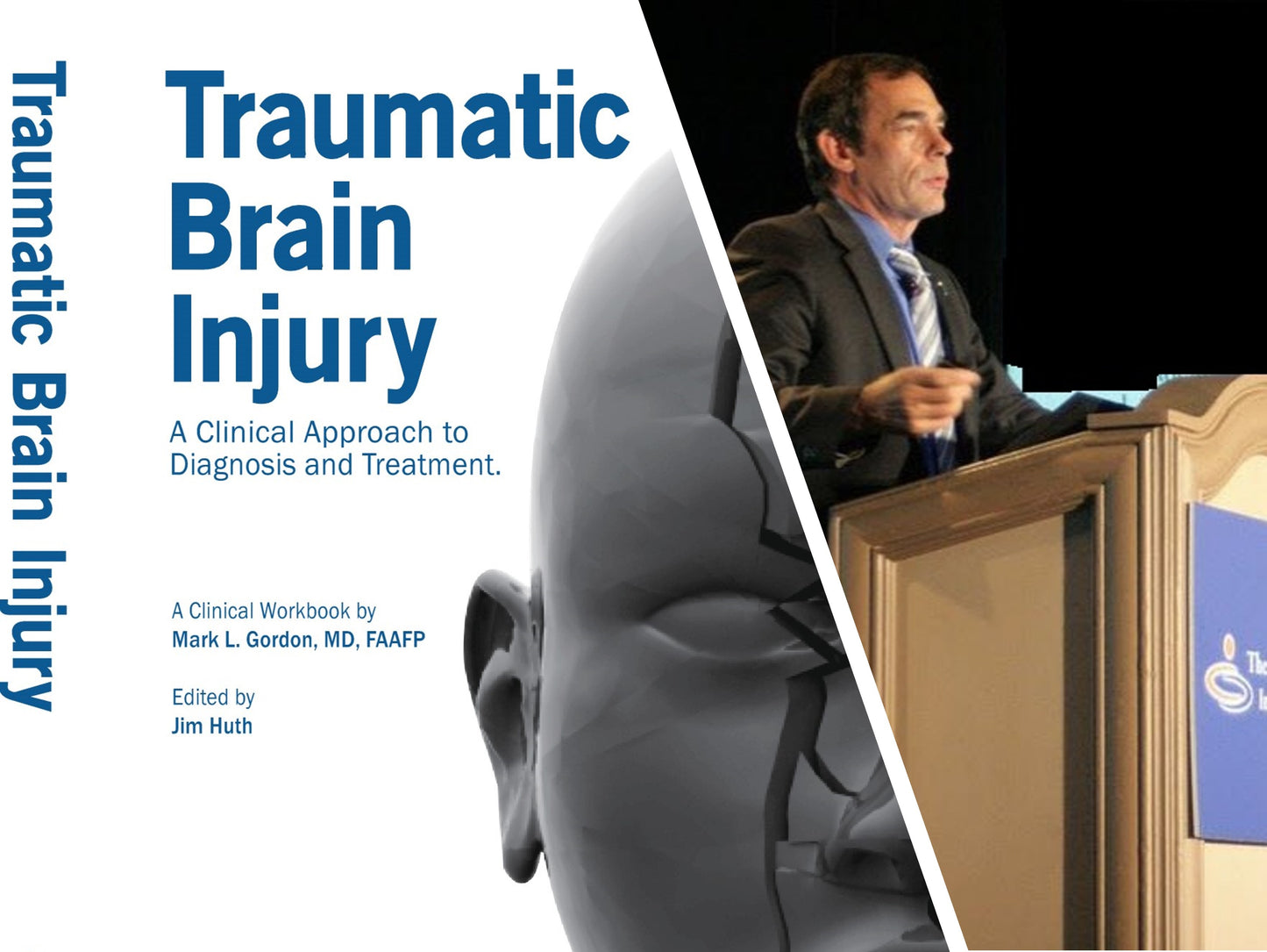 TBI On-Line Lecture Series